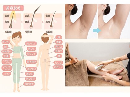 痩身・脱毛サロン Refin+ 小顔・毛穴ピーリング 【5月中旬 OPEN(予定)】 の写真