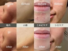 ルディラ 町田店/ルディラ医療提携エステ