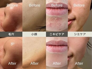 ルディラ 町田店/ルディラ医療提携エステ