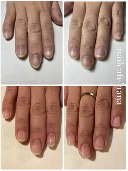 ネイルカフェ ナナ(nailcafe'nana)/自爪育成矯正