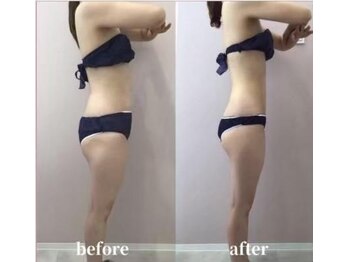 セカンドハウス(Second house)/ビフォーアフター(K様)