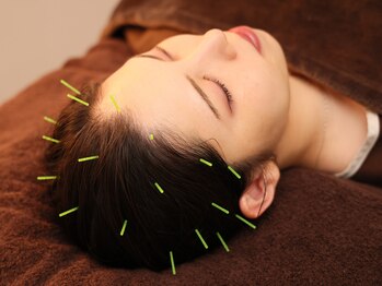 鍼灸院ワタナベコウヘイ(Watanabe Kohei)/頭皮にも鍼をします!