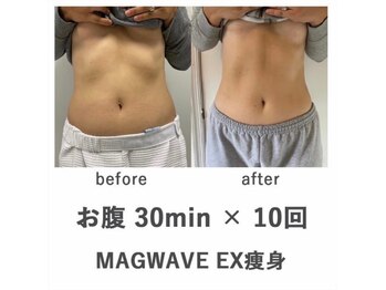 ロゼッティ(ROSETTY)/痩身/マグウェーブ/筋トレ