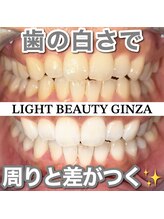 ライトビューティー 銀座店(LightBeauty)/東銀座 ホワイトニング 症例写真