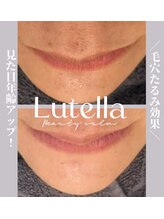 ルテラ(Lutella)/タルミくすみシミ改善エステ