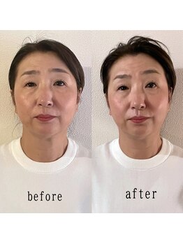 ラ アクサル(la.akthar)/小顔 全身 骨格矯正 整体