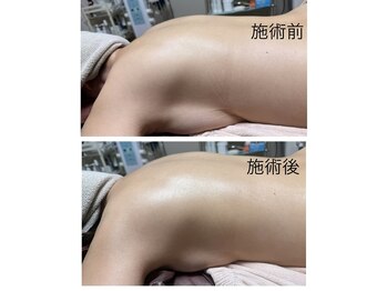 ルシアル(LUCIALL)/