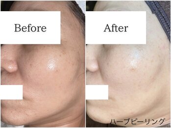 グラシア(gracia)/シミ・毛穴ケア専門店gracia