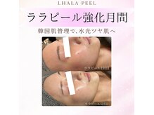 ナーズ(NAZ)の雰囲気（【先着5名様限定】1ヶ月間ララピールでツヤ肌を一気に底上げ♪）