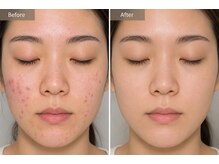 スパエスター 銀座本店(SPA Esther)/ビフォーアフター