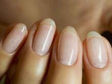 エクリュ(ecru)/リカバリーケアコース。おすすめ