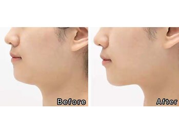 フイ(Hui)/お客様大満足