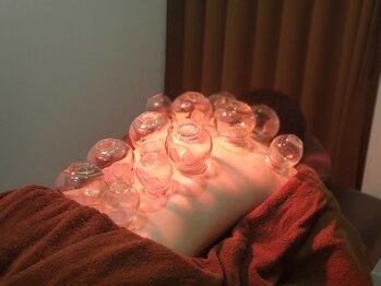 カーム(Calm)/吸玉