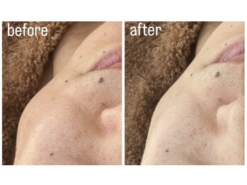 メナードフェイシャルサロン 岐阜茜部/美白/透明感/毛穴