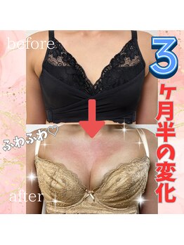 カリス(CHARIS)/しっかりサイズアップしました♪