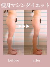 ハナメ(HANAME)/脚太りのお悩みお任せください！