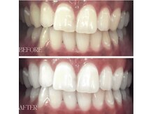 ホワイトニングラボ 八尾店(Whitening Labo)