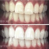 ホワイトニングラボ 八尾店(Whitening Labo)