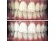 ホワイトニングラボ 八尾店(Whitening Labo)の写真
