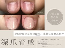 爪悩み専門店