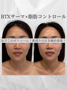 サロン ド ナース ユー ソナ(salon de nurse U.sona)/立体的なお顔の造形