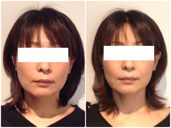 美容整体 ウェリナ 蟹江院/小顔矯正/骨盤矯正/美脚サロン