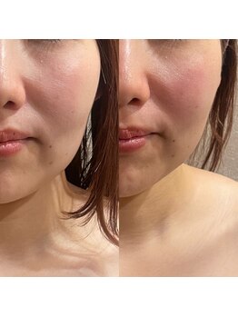 トゥーリ 春日店(tuuli)/ビフォーアフター