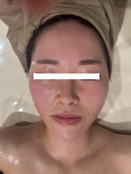 ありひ/3Dコルギの効果！！