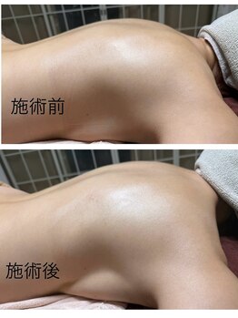 ルシアル(LUCIALL)/