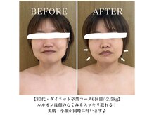 ヨサパーク プリズム 池袋東口(YOSA PARK Prism)/Before&After