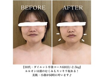 ヨサパーク プリズム 池袋東口(YOSA PARK Prism)/Before&After