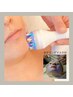 【シワ・たるみに】EMSリフトUPケア90分　￥5800
