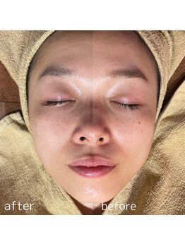 クーラ テュセ(Coeur la Tusais)/目元が引き上がるだけで印象◎