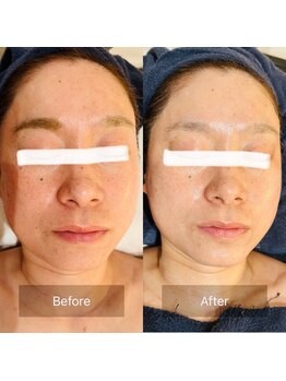 シエロ(Cielo)/1度で実感☆陶肌トリートメント