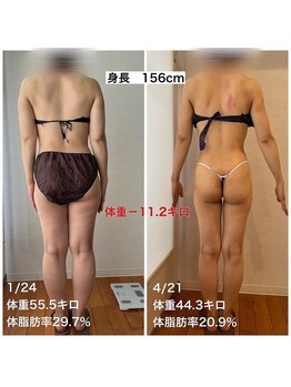 リモアボーテ(RIMOA beaute)/【ダイエット】before→after