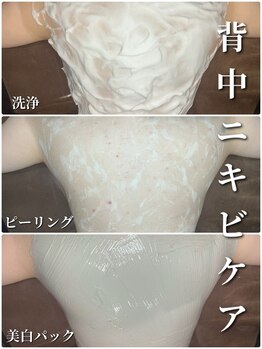 シン(Shin)/【背中ニキビケア】