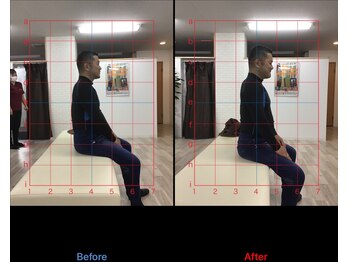 ストレチックス 近江八幡店/BeforeAfter