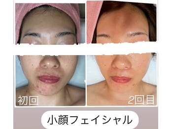 ビースペース 神戸新開地店(Bspace)/いつまでも美しく、私らしく☆