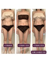 パラアモール(Paraamor)/お腹がどんどんスリムに！