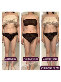 パラアモール(Paraamor)/お腹がどんどんスリムに!