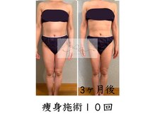 アイ エステサロン(Ai)/【５０代】増える恐怖から脱出！