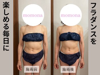 モモナ(Momona)/#肩こり#リンパマッサージ#野並