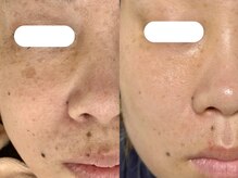 ポモナ 横浜馬車道店(Pomona)