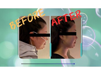 ヨサパーク タルタルーガ(YOSA PARK Tartaruga)/Before　After