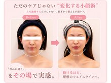 小顔フェイスラボ 姫路店(小顔 Face Labo.)の雰囲気(5回目からは無料で小顔矯正をプレゼント!骨格から小顔に改善♪)