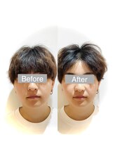 ワカヤマ 小顔(Wakayama)/★Before・After★