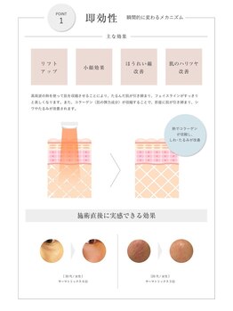 メルリー(Meruly)/サーマトリックスについて【1】