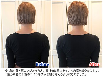 ラシュシュ/ビフォーアフター