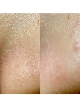 ビビッシュアール(bibiche R)/ハイドロスプラッシュ　