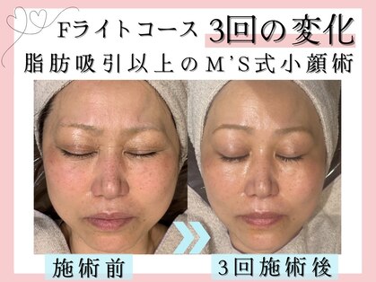 エムズボーテ(M's beaute)の写真